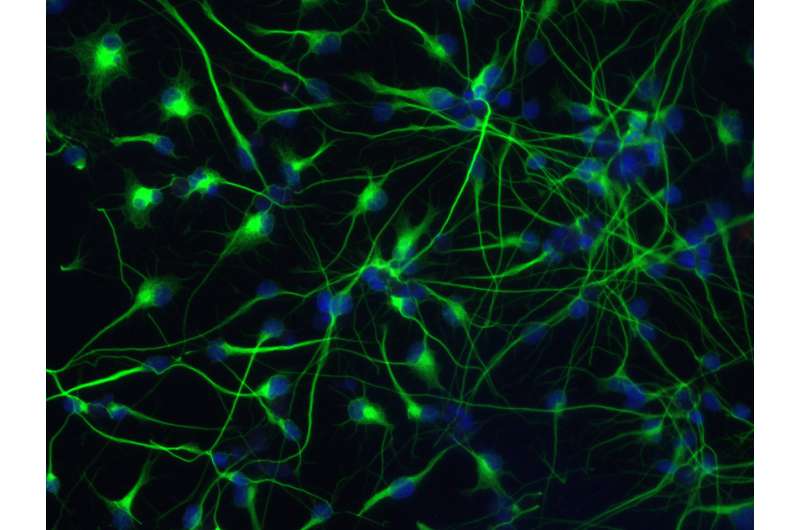 Improving the neuron factory -- new modulator of stem cell identity found