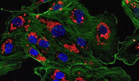 Nanoparticles trick body into accepting organ transplants