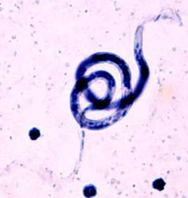 Researchers profile symbiotic relationship between bacteria and filarial nematodes
