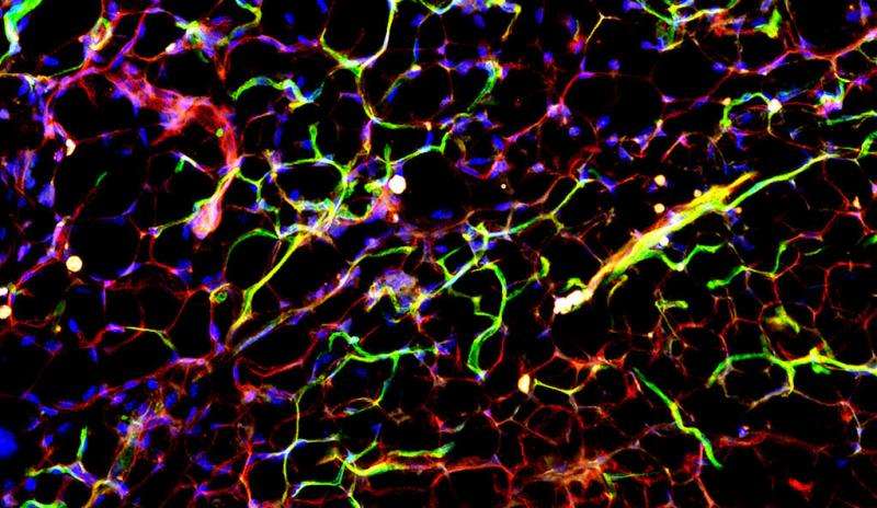 Study identifies blood vessel as a therapeutic target for diabetes