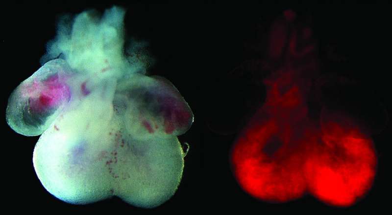 Researchers identify cells linked to the development of the heart's ventricular chambers