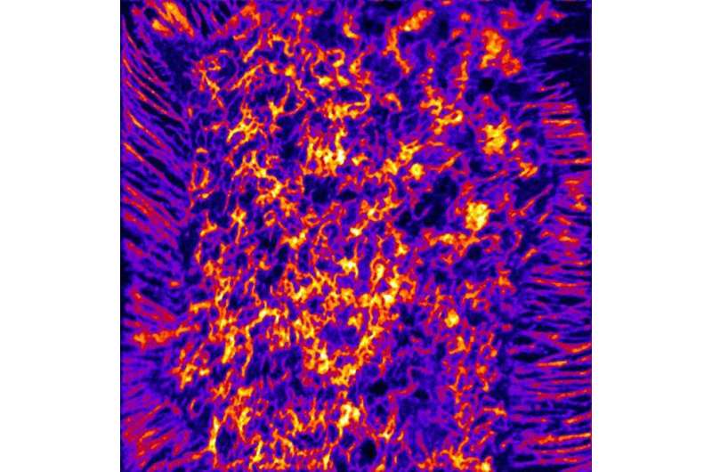 Researchers explore a new method to study cholesterol distribution on cells