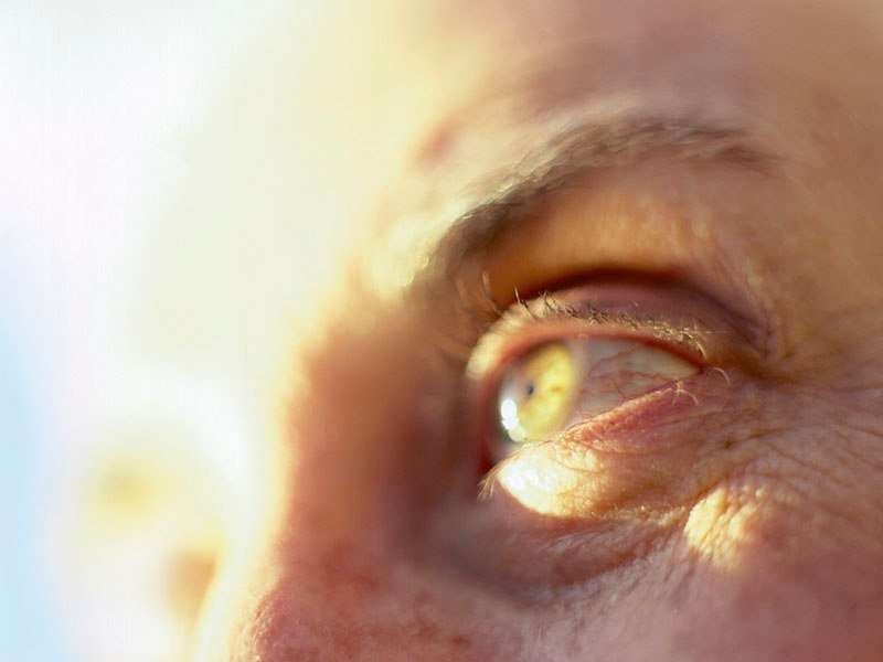 18-item measure reliable for symptom burden in glaucoma
