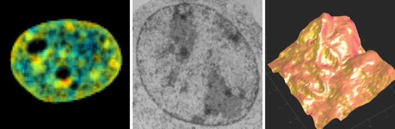 Research reveals how cells rebuild after mitosis