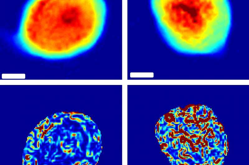 A better way to measure the stiffness of cancer cells
