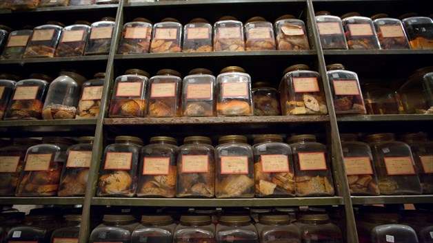 Century-old brain collection yields new research