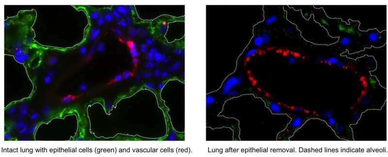 Columbia engineers and clinicians first to build a functional vascularized lung scaffold