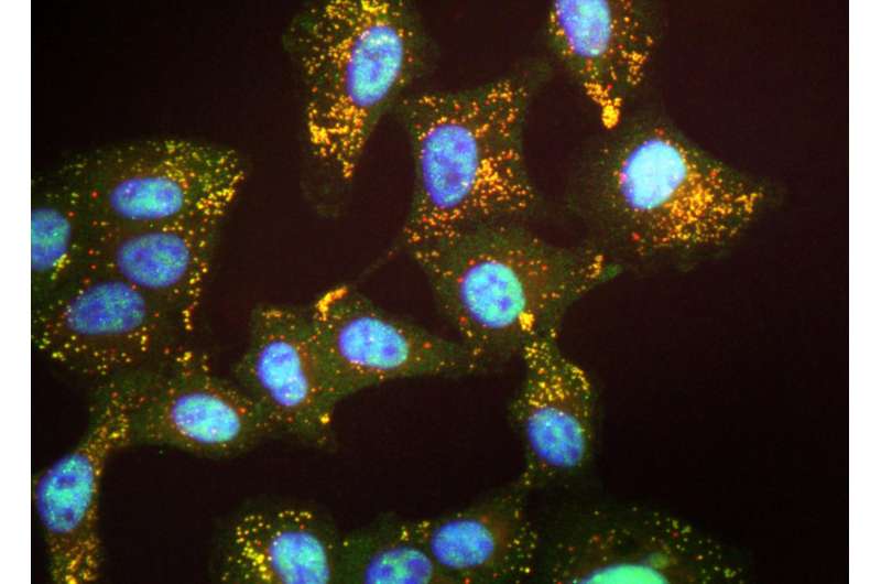 Experimental drug targets nucleus of allergen-sensitized cells