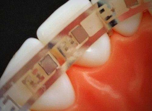 Flexible batteries a highlight for smart dental aids