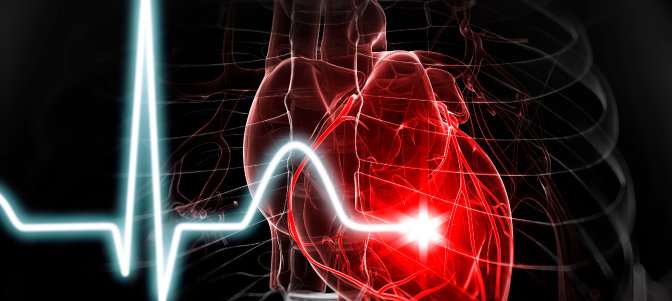 Heart disease and stroke deaths decline slightly, new statistics find