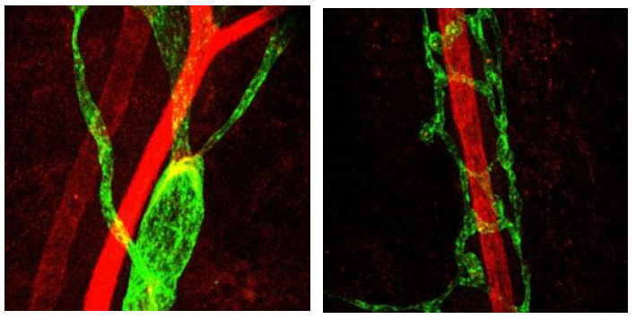 Identification of protein crucial to lymphatic system development