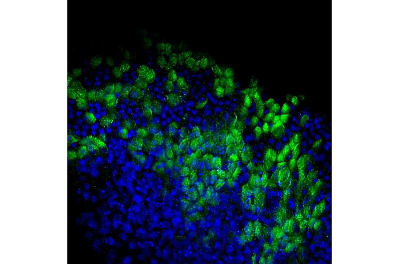 Interrupted reprogramming converts adult cells into high yields of progenitor-like cells