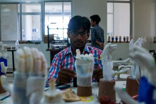 In this photograph taken on June 13, 2017, a technician adds a battery to prosthetic hands at the Bhagwan Mahaveer Viklang Sahay