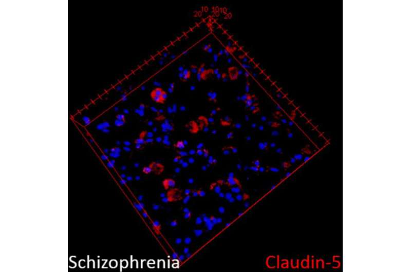 Major breakthrough identifies new mechanism for the development of schizophrenia