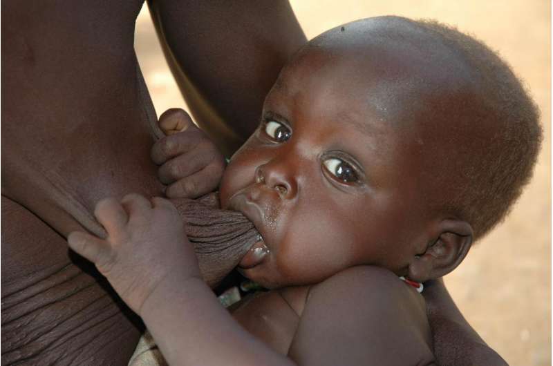 New research to treat acute malnutrition