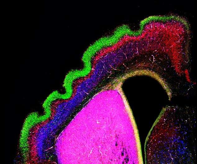 The formation of folds on the surface of the brain
