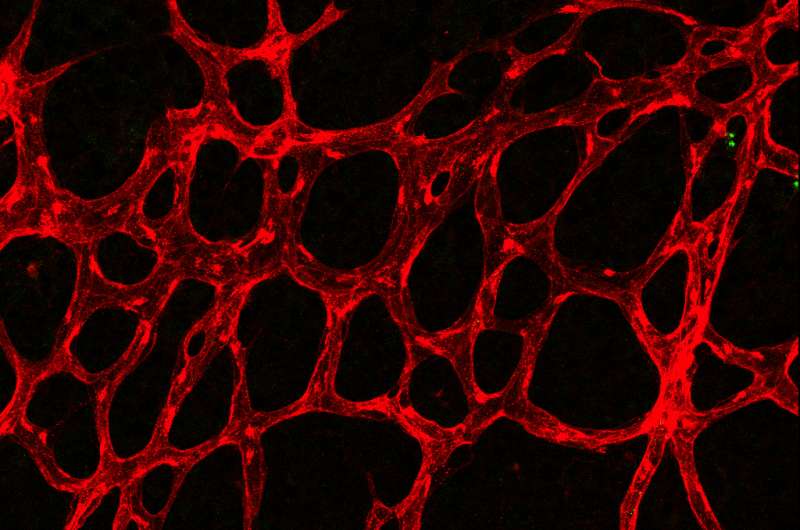 Tracking the mechanisms of artery formation