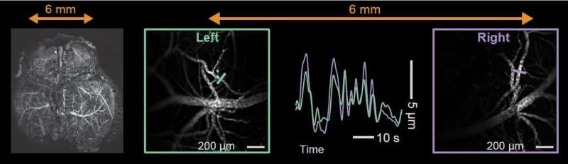 UC San Diego researchers solve mystery of oxygenation connections in the brain