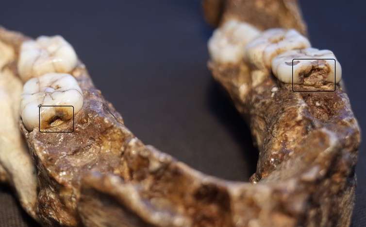 What teeth can reveal about the secret lives of our ancestors