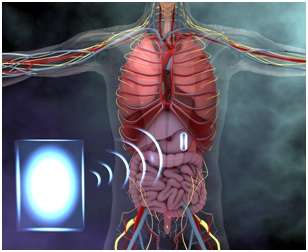 Wireless power can drive tiny electronic devices in the GI tract