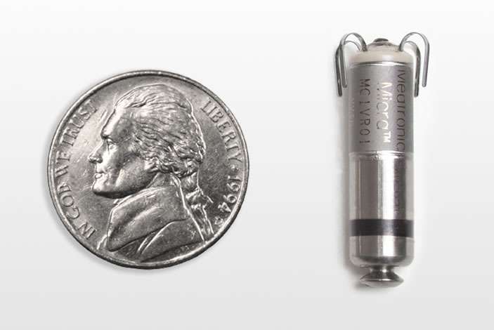 World's smallest, leadless pacemaker yields positive results