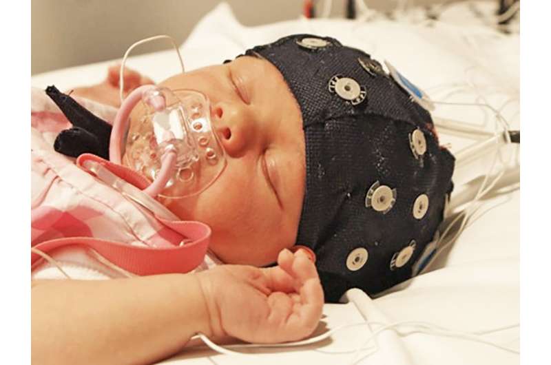 Artificial intelligence to evaluate brain maturity of preterm infants