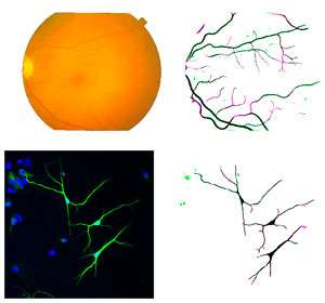 Computational tool recognizes filamentary sections of neurons and blood vessels