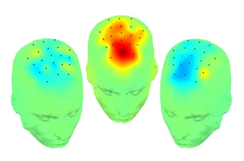 Low frequency brain stimulation improves cognition in Parkinson's disease