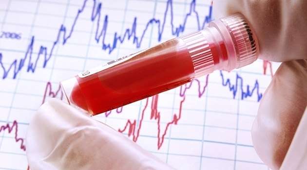 新的血液检测显示有患冠状动脉疾病的风险