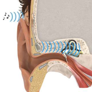 New bone conduction hearing aid passed long term endurance test