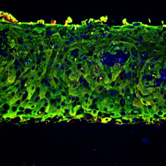 3-D skin made of stem cells treats backbone birth defect in rodents