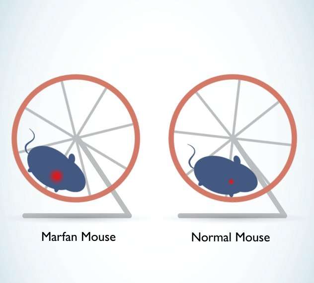 Researchers reverse heart failure in Marfan mice