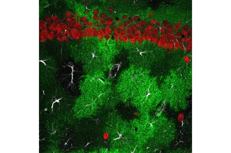 Discovery of new pathway in brain has implications for schizophrenia treatment