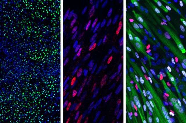 Researchers turn stem cells into somites, precursors to skeletal muscle, cartilage and bone