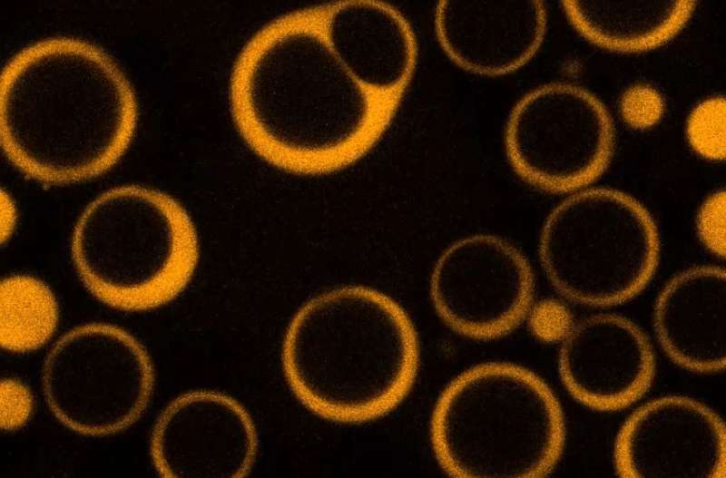 Scientists solve a mystery in cellular 'droplet' organelles