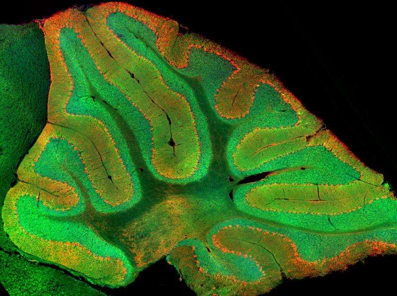 Stanford scientists find a previously unknown role for the cerebellum