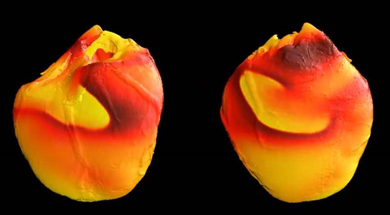 Researchers find new source of dangerous electrical instability in the heart