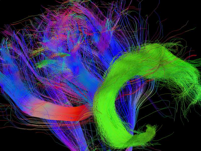 Researchers discover brain structure that helps us to understand what others think