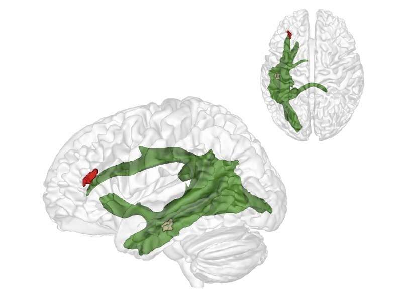 Researchers discover brain structure that helps us to understand what others think
