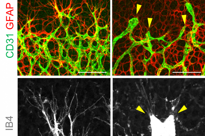 Scientists discover key regulator of blood vessel formation