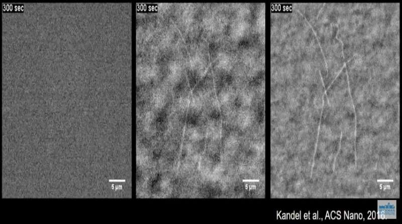 Researchers develop label-free technique to image microtubules