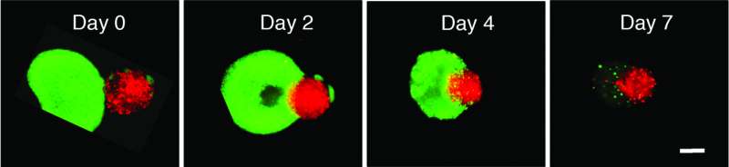 Revolutionary approach for treating glioblastoma works with human cells