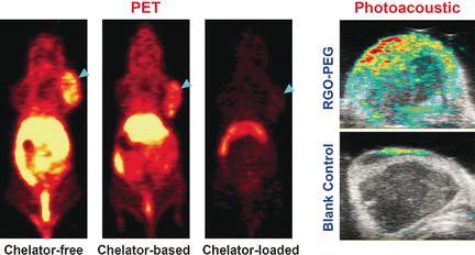 Directly radiolabeled nanographene materials without chelators are suitable for bioimaging applications