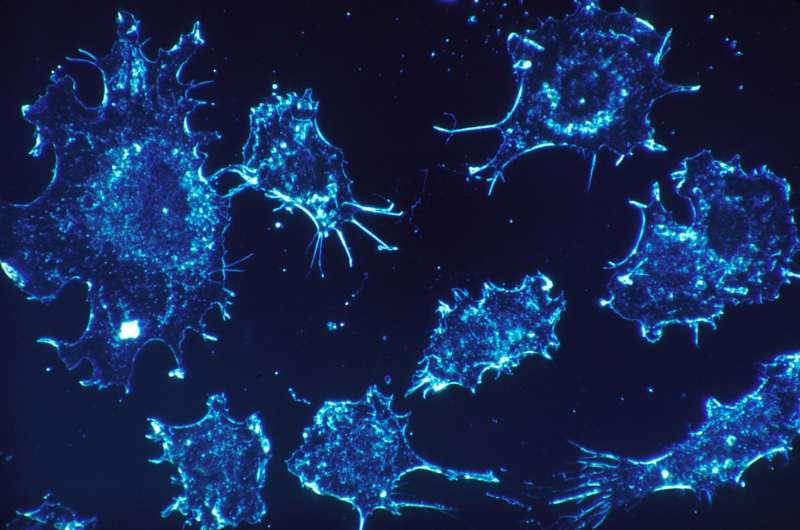 Researchers discover new inhibitor drug combination for rare form of cancer thumbnail