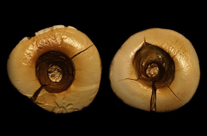 Ancient teeth offer evidence of Ice Age dentistry