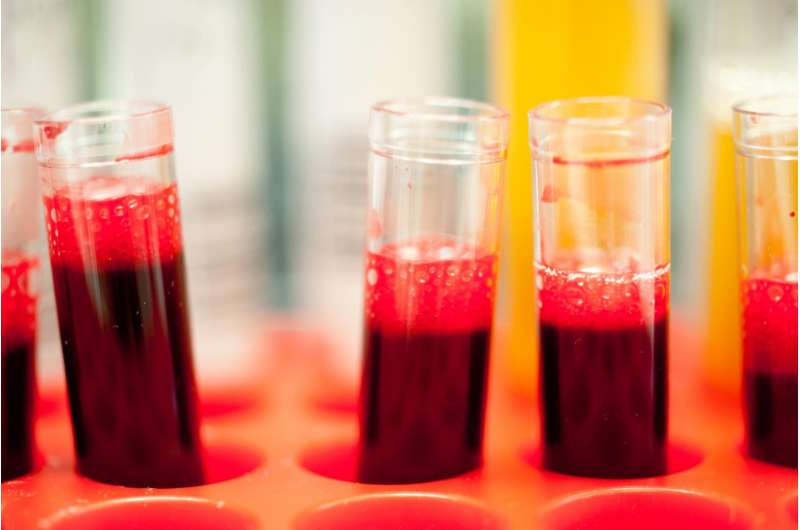 New blood test predicts who will benefit from targeted prostate cancer treatments