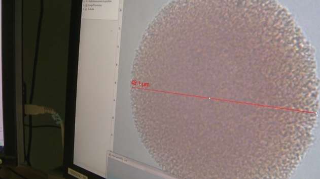 New microscopic technique could help detect, diagnose metastatic melanomas