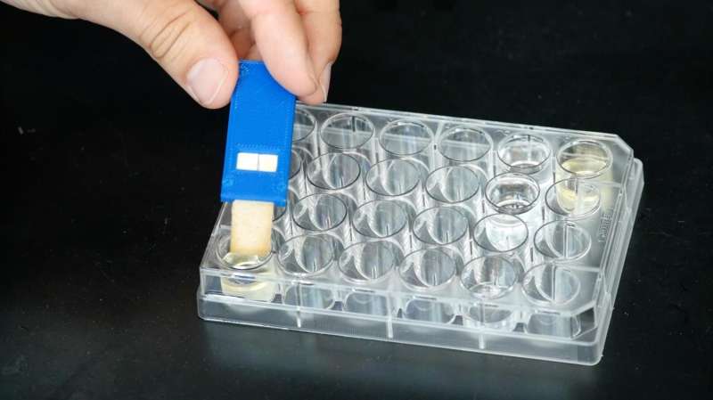 Researchers develop yeast-based tool for worldwide pathogen detection