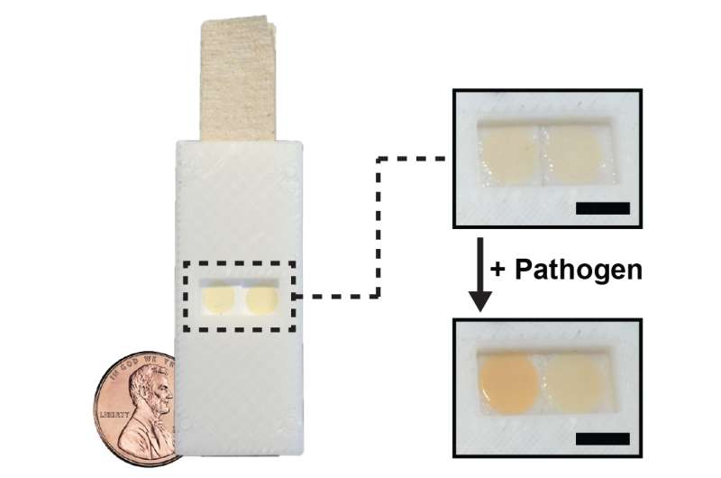 Researchers develop yeast-based tool for worldwide pathogen detection