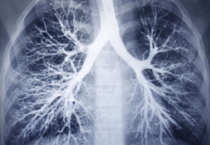 Nano-sized drug carriers could be the future for patients with lung disease